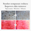 Red Succinic Acid Panthenol Pads