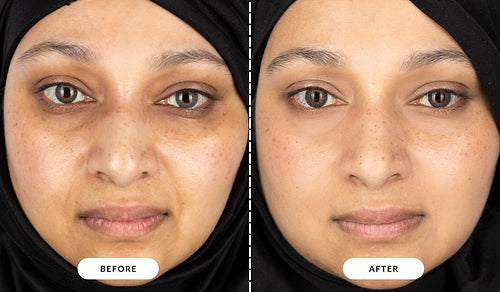 Refreshes the complexion - Nicola, UK