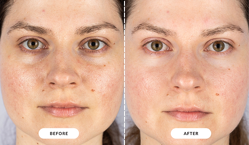 Reduces fine lines and wrinkles Alessandra, UK