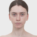 Red Succinic Acid Serum