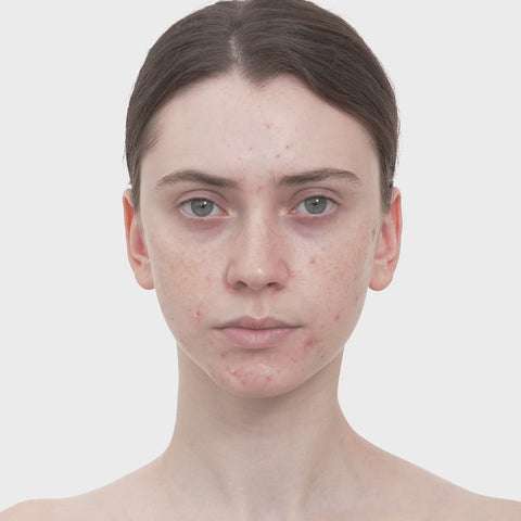 Red Succinic Acid Serum