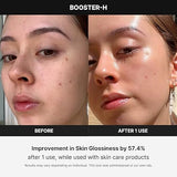 Booster H