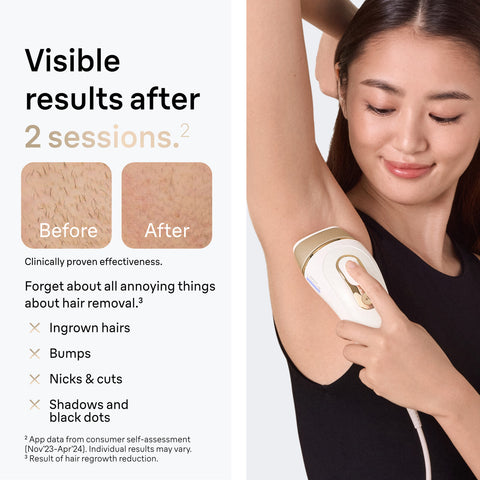 Braun Smart IPL, Silk·Expert