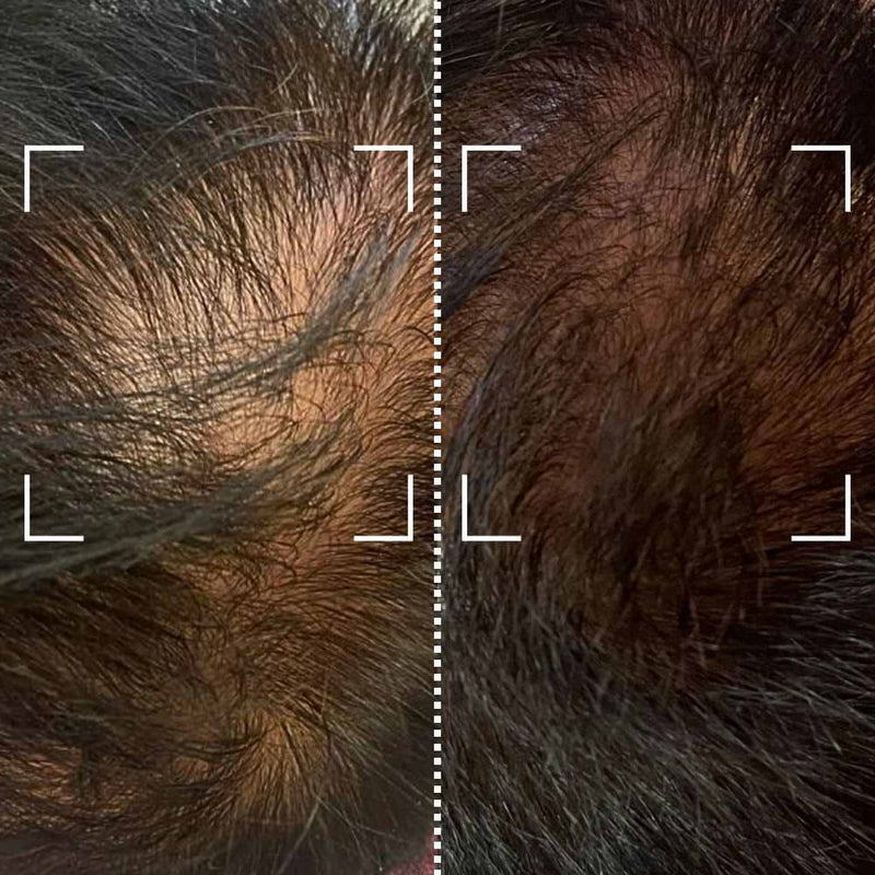 Favorise la repousse des cheveux - John, Royaume-Uni