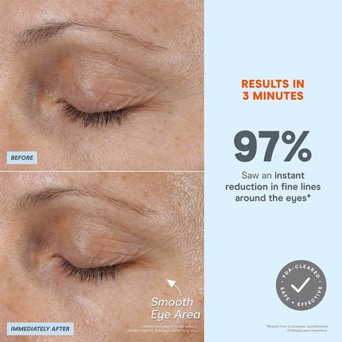 NuFACE FIX MicroWand