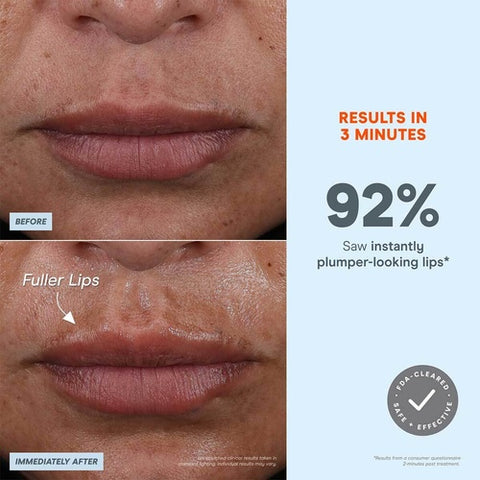 NuFACE FIX MicroWand