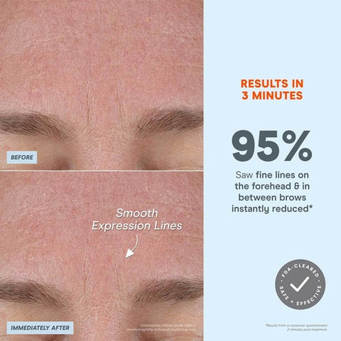 NuFACE FIX MicroWand