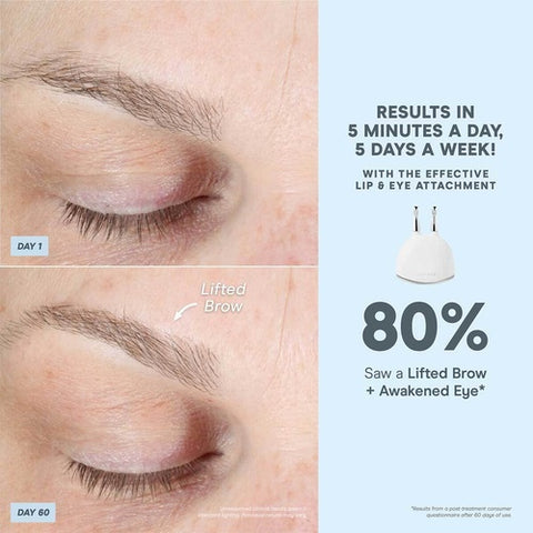 NuFACE TRINITY+ et fixation efficace des lèvres et des yeux