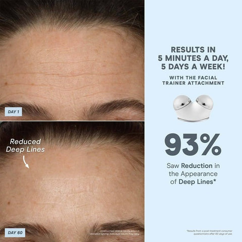 NuFACE TRINITY+ et fixation efficace des lèvres et des yeux